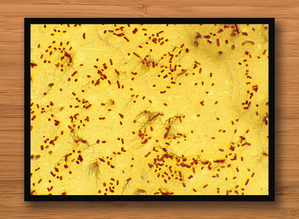 microscopic photo of bacteria (yellow)