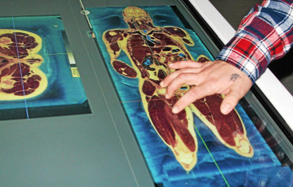 Image of the virtual cadaver table with a hand operating it. 